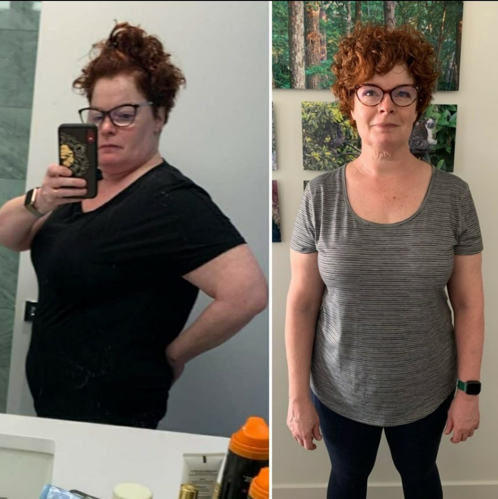 Before and after photo of a woman client